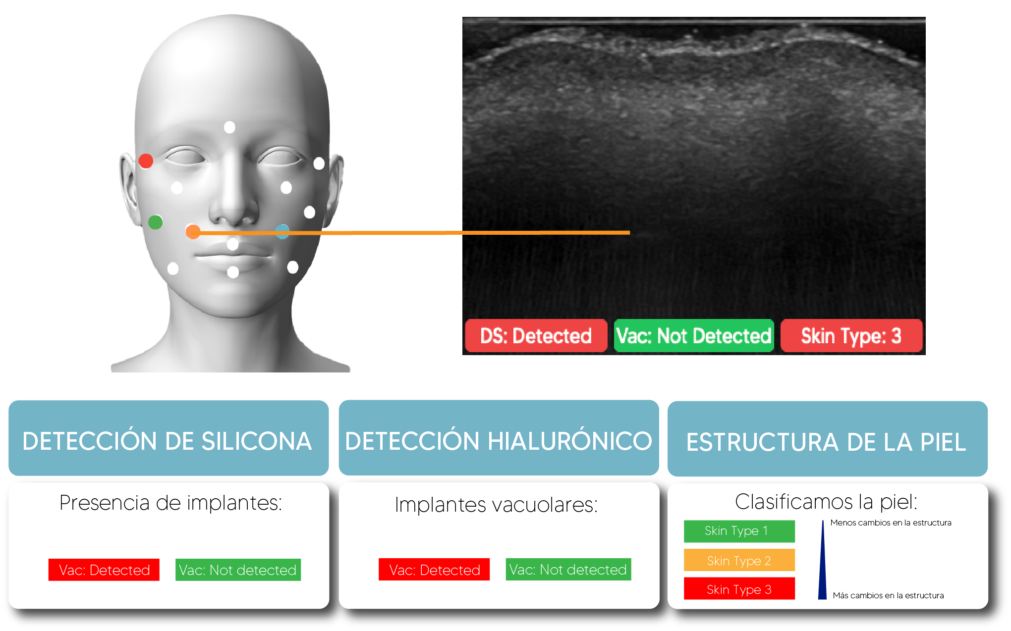 Detección de implantes con Nesai FACE