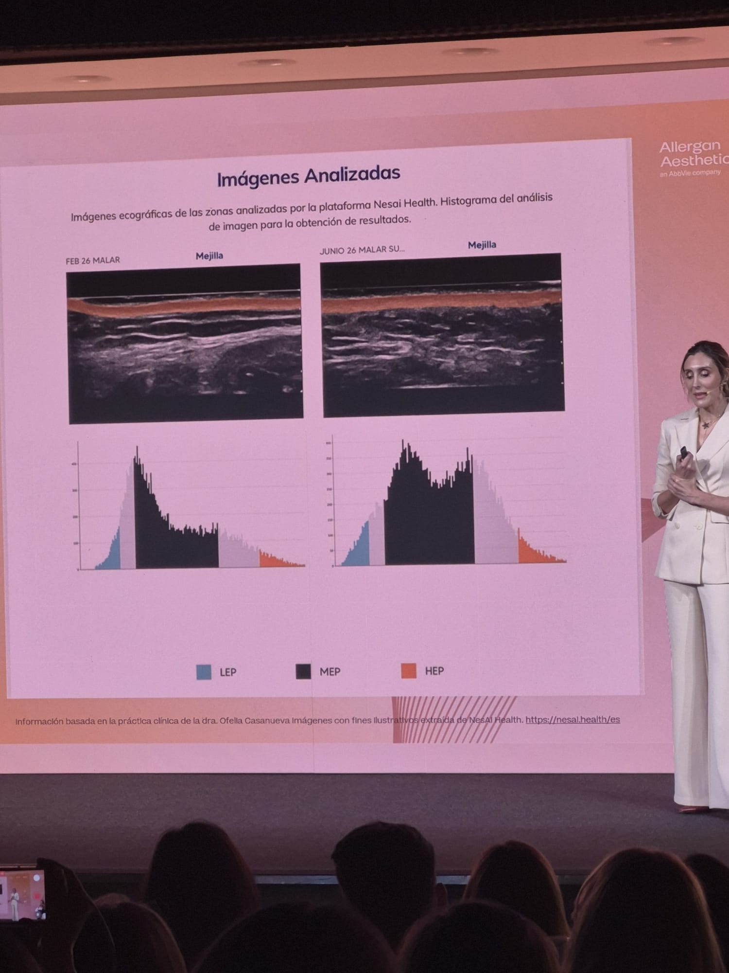 Dra. Ofelia Casanueva presentando resultados con Nesai Derm en el evento A3 de Allergan Aesthetics 2026