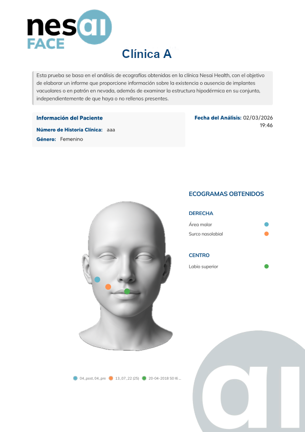 Portada del informe Nesai Face con mapa de ecogramas obtenidos